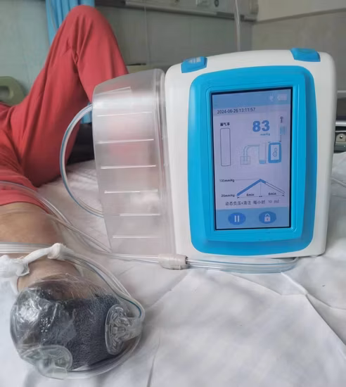 Sistema de terapia de presión negativa Npwt Dispositivo para la curación de heridas con bote 1200